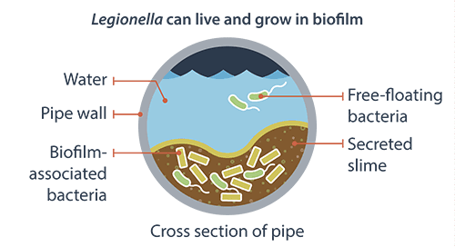 Pakar Jelaskan Beberapa Hal yang Perlu Diketahui tentang Legionella