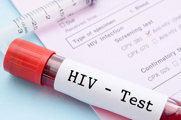 Dinkes Jabar Lakukan Berbagai Upaya Cegah Penularan HIV/AIDS