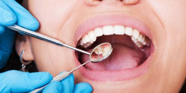 Gigi tidak Rapi Sebabkan Masalah Kesehatan