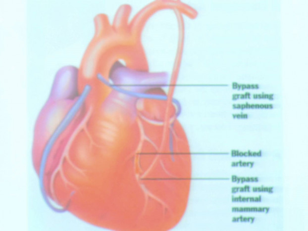 Mengenal Pembuluh Darah Arteri, Vena, dan Kapiler serta Fungsi