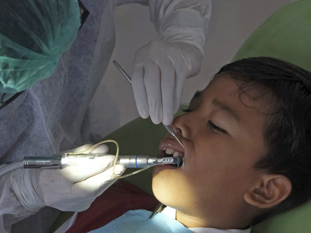 Cara Menghilangkan Karang Gigi Sendiri, tanpa ke Dokter