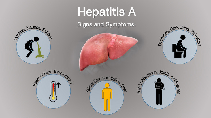 Mengenal Penyakit Hepatitis A, Penyebab, Gejala, dan Pencegahannya