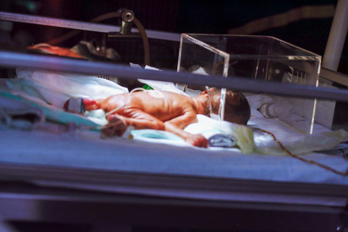 Saran Peneliti untuk Selamatkan Bayi-Bayi Prematur 