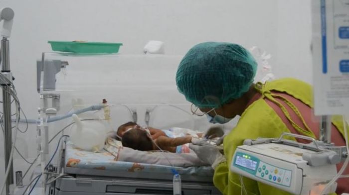 Salah Satu Bayi Kembar Siam di Larantuka Meninggal Setelah Operasi Pemisahan