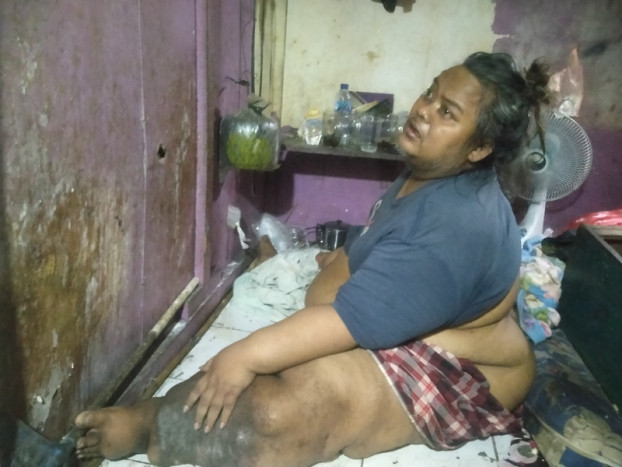 Obesitas Hingga 200 Kilogram, Tukang Ojek di Tangerang Harapkan Bantuan Pemerintah
