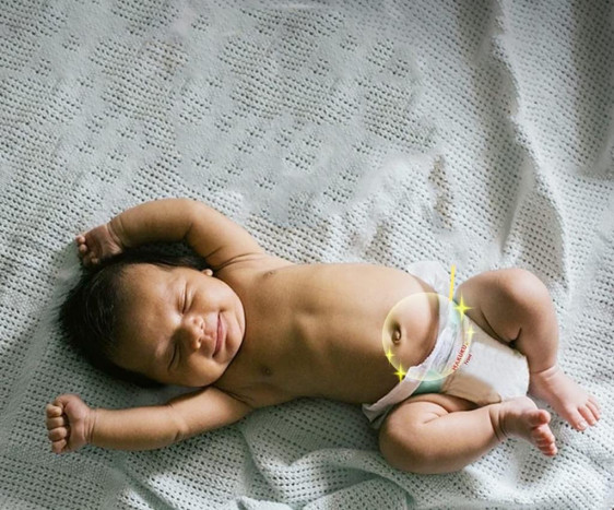 Beberapa Hal Perlu Diperhatikan Terkait Tali Pusat Bayi