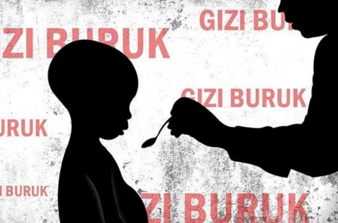 RSUD Bulukumba Rawat Bayi Gizi Buruk, Sudah Sering Bolak Balik Berobat  