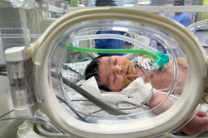 Dua Bayi Prematur di Gaza Meninggal, Dokter Israel:  Ini Hukuman Kolektif