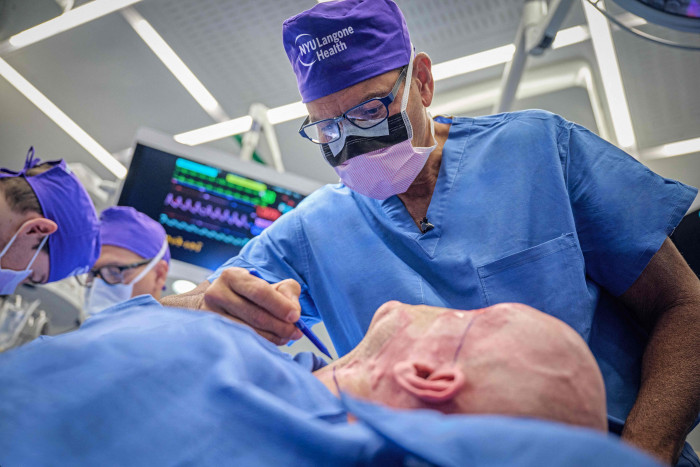  Ahli Bedah AS Melakukan Transplantasi Mata Utuh Pertama di Dunia