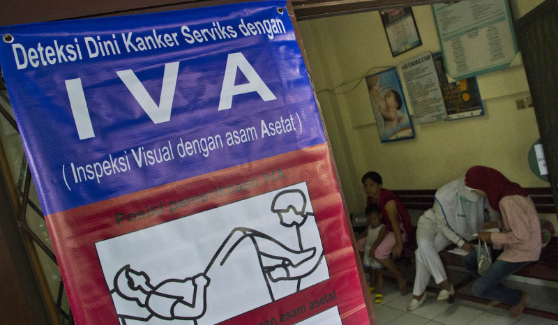 Perempuan Indonesia Peduli Deteksi Dini Kanker Serviks Baru 19 Persen