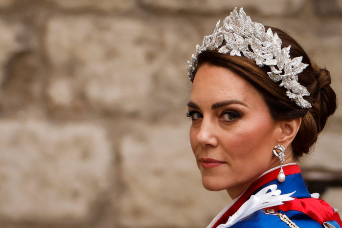Putri Wales Kate Middleton Dirawat Seusai Jalani Operasi Perut