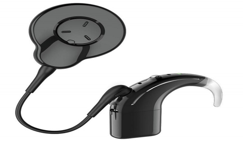 Kasoem Hearing Center Luncurkan Cochlear Implant Nucleus 8 Sound Processor (N8)