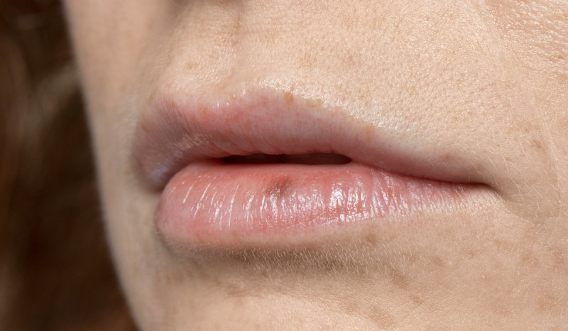 7 Tips Menjaga Bibir Tetap Lembut dan Tidak Pecah-pecah Selama Puasa