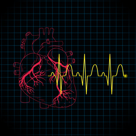 Sudah Pasang Ring Jantung? Hati-hati Risiko Serangan Jantung Masih Ada