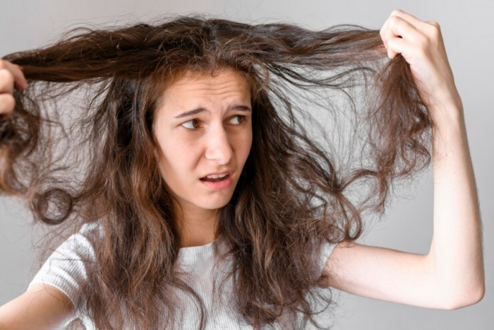 Penyebab Rambut Rontok, Begini Cara Merawat yang Benar agar Sehat dan Kuat