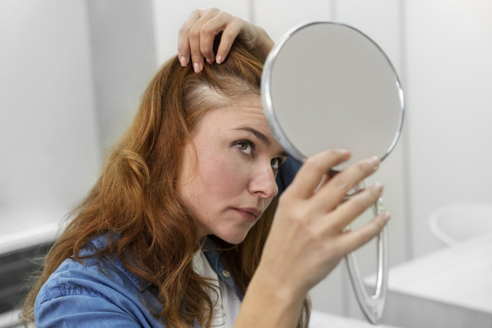 Solusi Mengatasi Ancaman Kebotakan pada Rambut